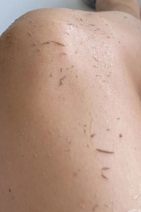 a reviewer's leg showing rolls of dead skin after exfoliation