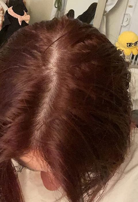 Customer's scalp after using the rinse.