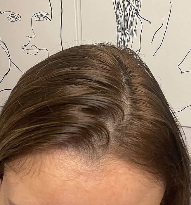 A before photo of a reviewer’s hair appearing oily and weighed down