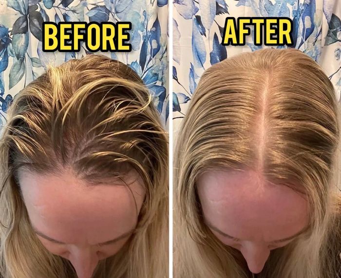 Reviewer's before and after photos showing a significant reduction in hair oiliness