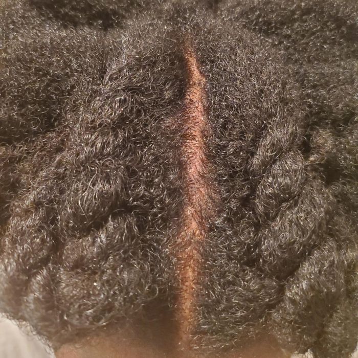Reviewer’s scalp free of dandruff after using the product.