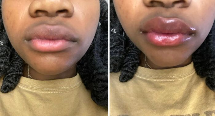 A reviewer's before and after photos showing more moisturized, glossy, and pink lips