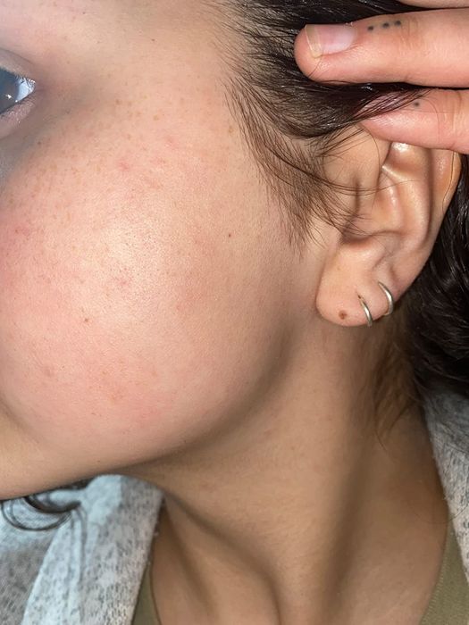 The same reviewer after using the tool, with no visible peach fuzz.
