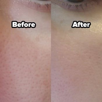 a reviewer's before-and-after close-up of their pores, first without and then with the primer, showing a visibly minimized appearance