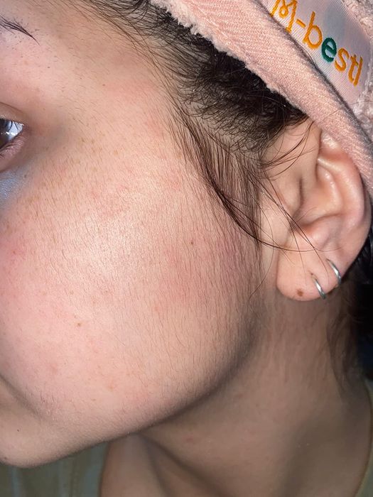 Another reviewer showing peach fuzz on their face before using the tool.