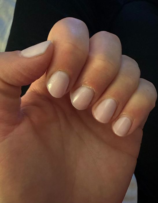 A reviewer’s photo showcasing the pink-toned concealer