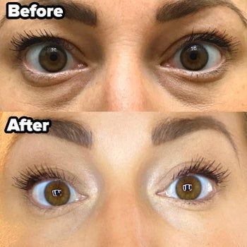 a reviewer's before-and-after photo showing dark under-eyes transformed into a brightened look using the concealer