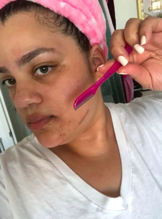 Image of a reviewer using a pink dermaplaning razor to remove baby hairs from their face