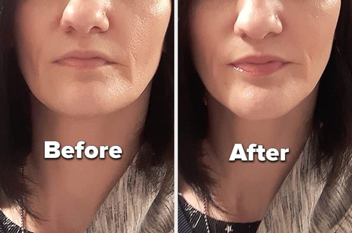 A reviewer showing the before-and-after effect of using the lip plumping gloss.