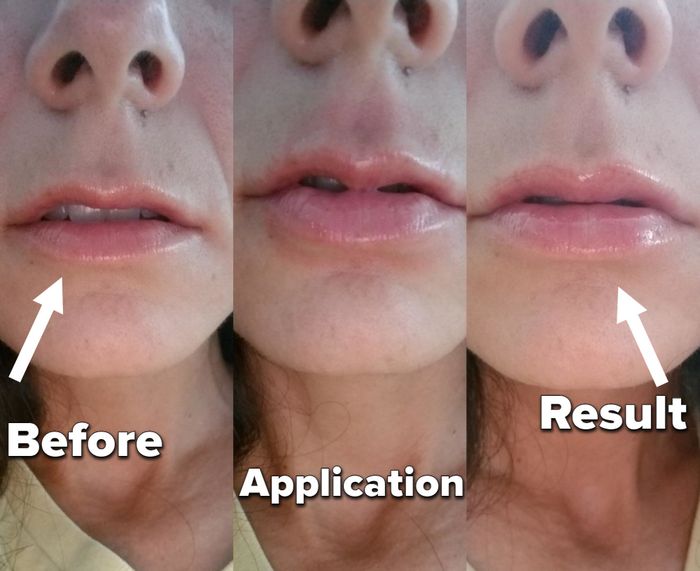 Before-and-after image from a reviewer showing the effects of the lip balm