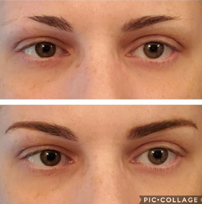 Top: A reviewer's eyebrows with many of the outer hairs missing. Bottom: The same reviewer after using the stencil to fill in their brows.