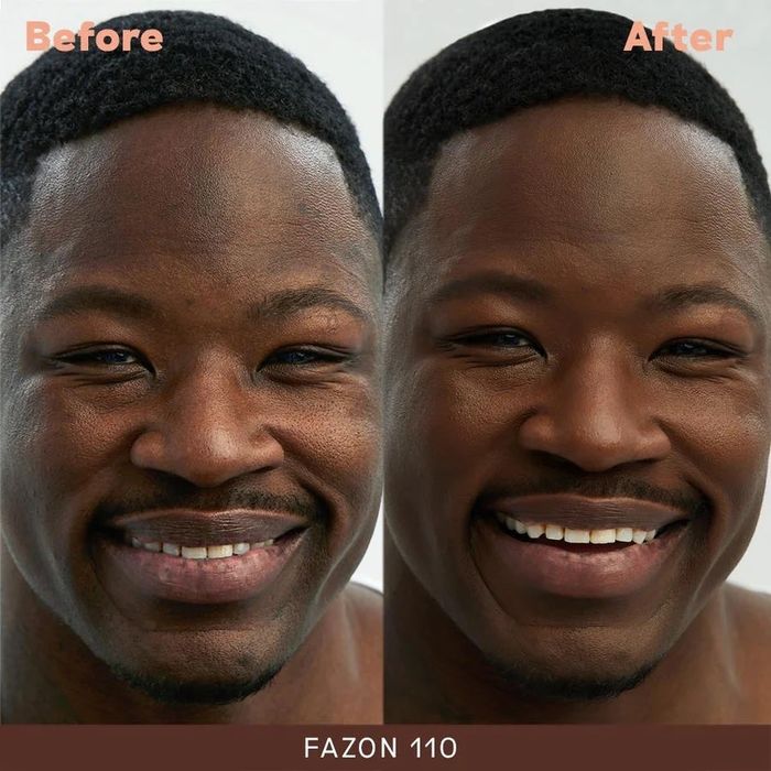 A model's before-and-after images showing the application of medium-coverage foundation