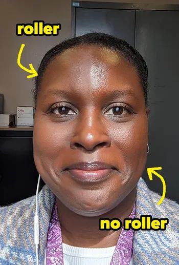 A comparison of the user's face, showing how one side looks noticeably matte after using the roller, while the other side retains its oily appearance