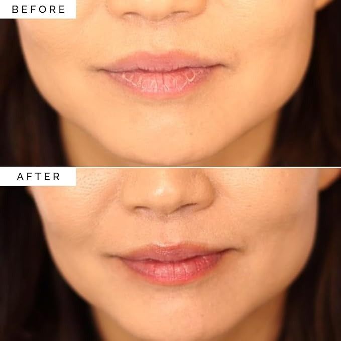 Close-up before-and-after image showing a woman’s lips. The top image features dry, chapped lips, while the bottom shows smooth, hydrated lips after use