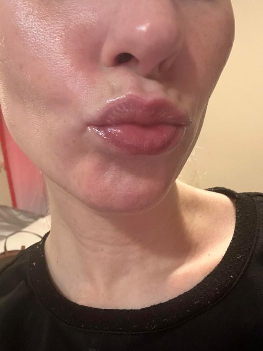 Close-up of a reviewer’s glossy lips with a lip mask applied and a subtle pout