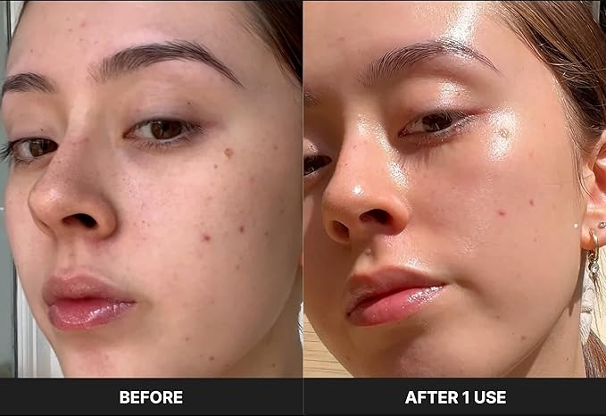 The model's performance before and after utilizing the device.