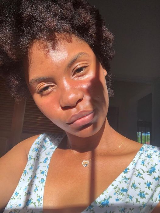 The reviewer's glowing, clear skin after using the spot treatment