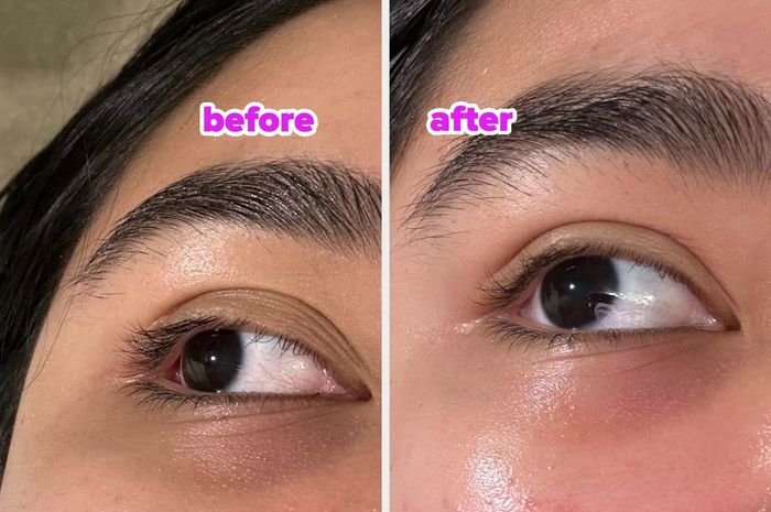 A side-by-side comparison of one eye before and after applying the eye serum