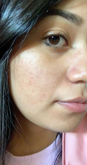 The reviewer's clear, radiant skin after using the serum