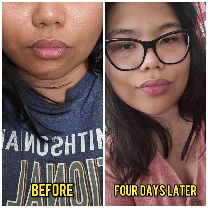 Split image of a reviewer showcasing their skin before and four days after using a skincare product, with a noticeable improvement in skin texture