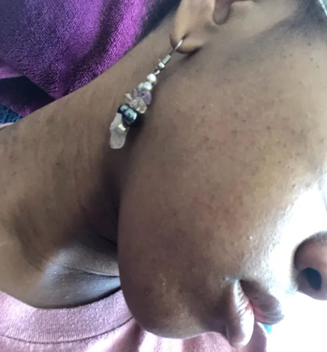 A reviewer photo showing their skin after using the product, now clear of acne.