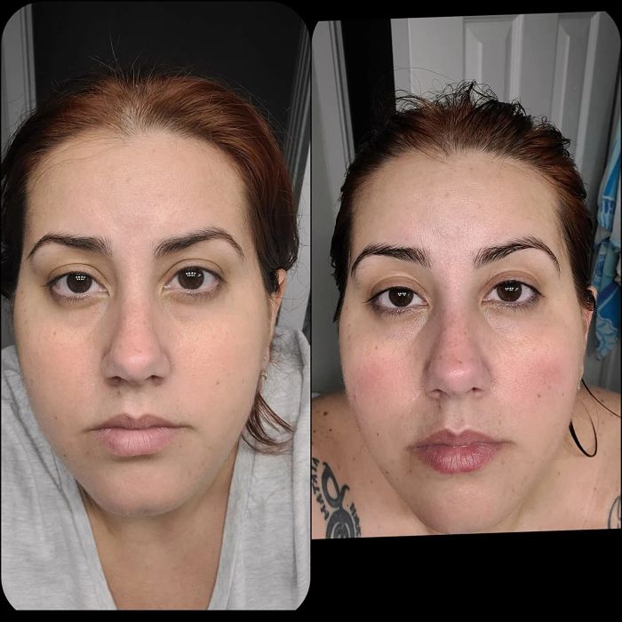 Before-and-after photos showing a reviewer with redness and irritation on their cheeks and some oiliness, followed by the same reviewer with noticeably more even-textured skin.
