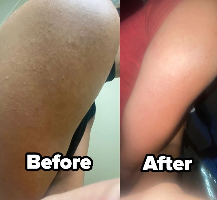 A split-image of the reviewer’s arm showing the results before and after using the body scrub.