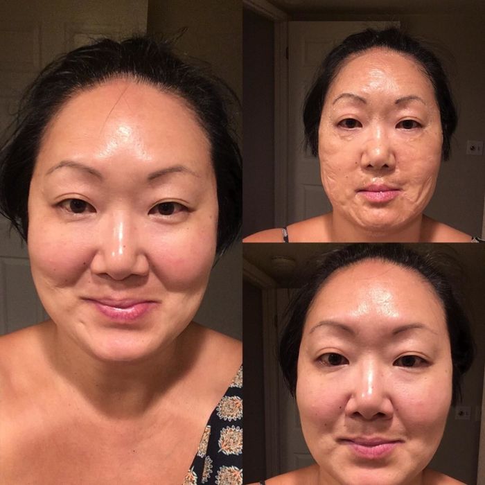Before and after photo of the reviewer with the face mask, demonstrating smoother skin