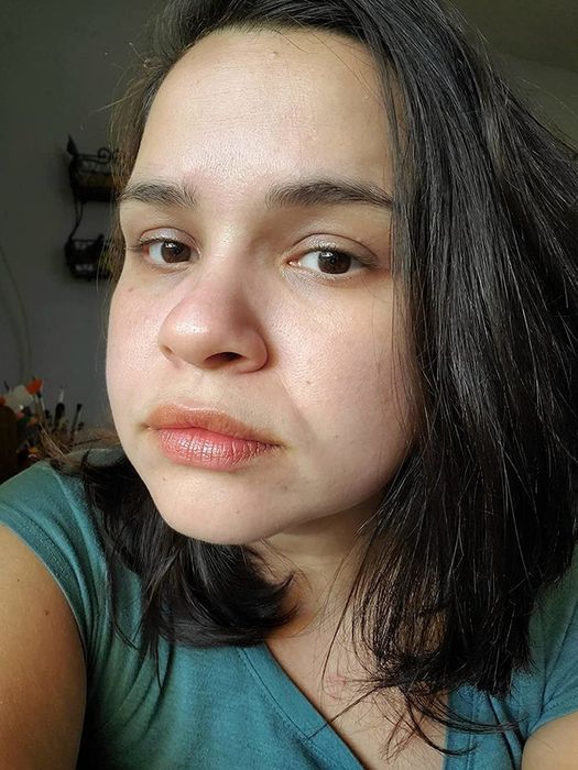 a reviewer’s skin after applying the Elta MD SPF moisturizer