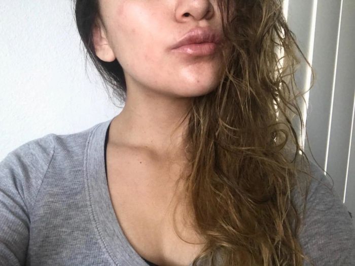 An after photo of the same reviewer with glowing, even skin that’s significantly less red.