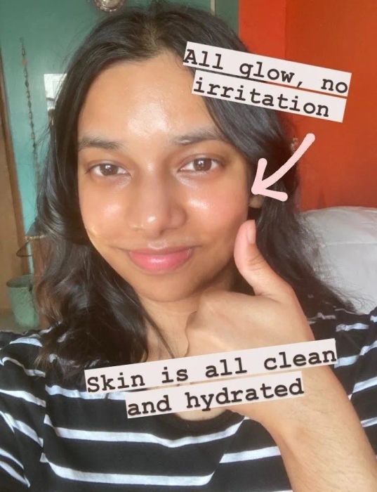 The same Mytour writer demonstrating her clean, glowing skin after using the cleansing balm.