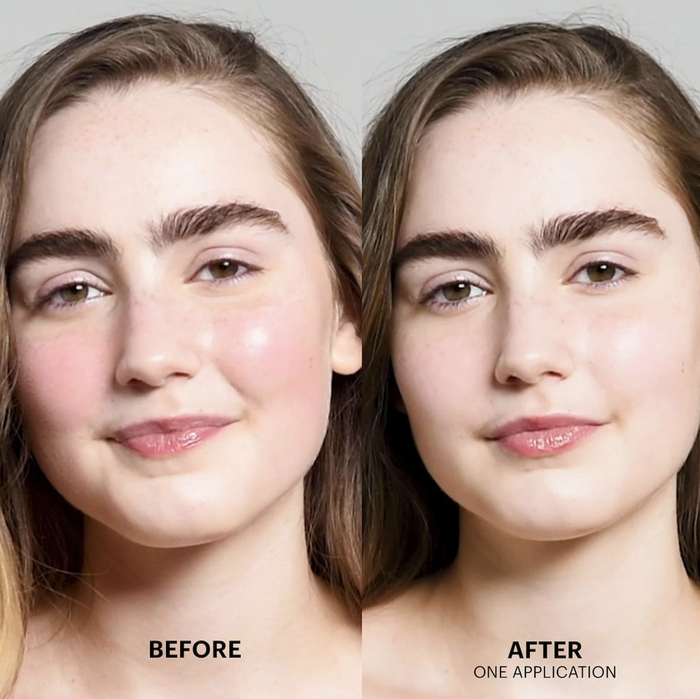 Model demonstrating the before and after effects of using Cicapair treatment