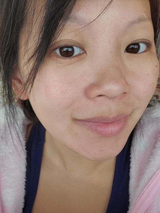 A customer showing visibly smaller pores after using the cleanser
