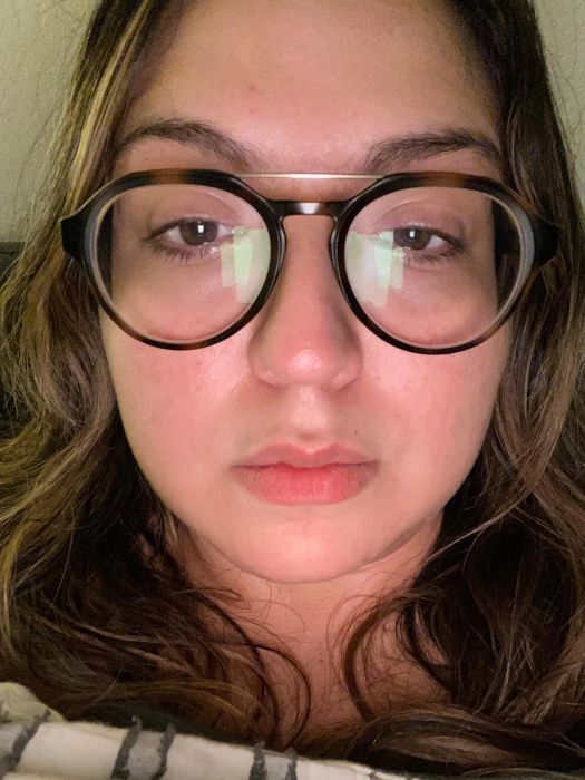 An after photo of the same reviewer, showing their skin clearer and less irritated.