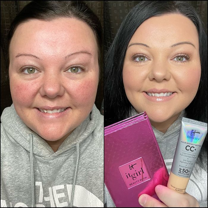 A reviewer showing their before and after photos, highlighting the noticeable improvements after applying the product.