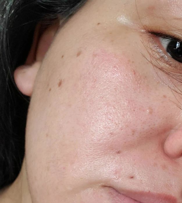 A close-up of a reviewer's cheek showing soft, hydrated skin after using the moisturizer.