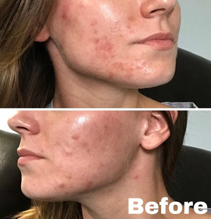 A reviewer’s skin before using the cream