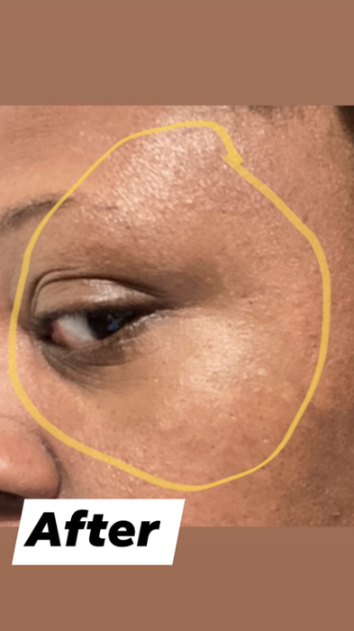 After photo of the same reviewer with a more even skin tone