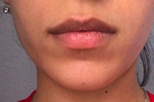 Reviewer’s photo of chapped lips before using the scrub