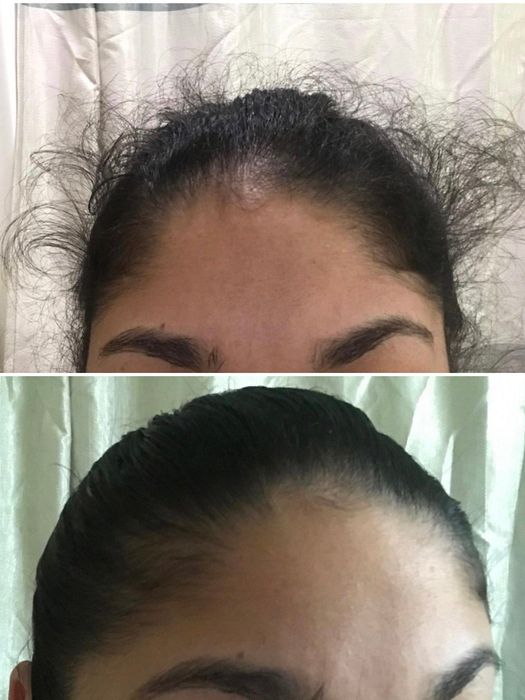 Reviewer with curly flyaway hairs around the forehead before using the stick, and a smooth hairline after application