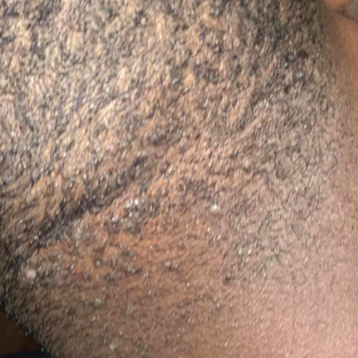 The same reviewer’s head looking significantly smoother after use