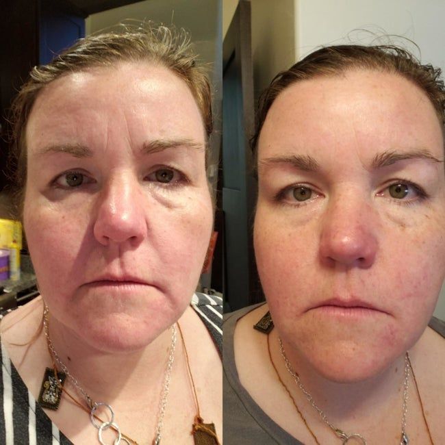 before and after images demonstrating how the cream diminished the reviewer's wrinkles and added a plump, youthful appearance to their face