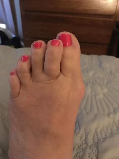 A reviewer’s toes are shown overlapping each other