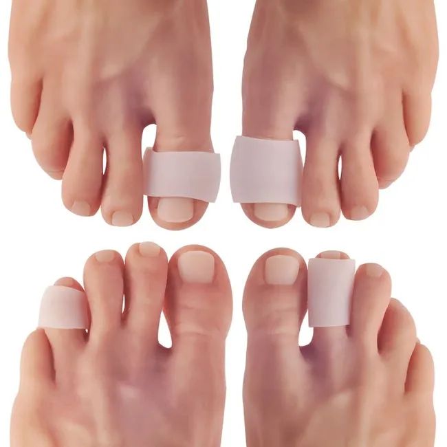 Two sets of feet wearing various toe protectors on different toes