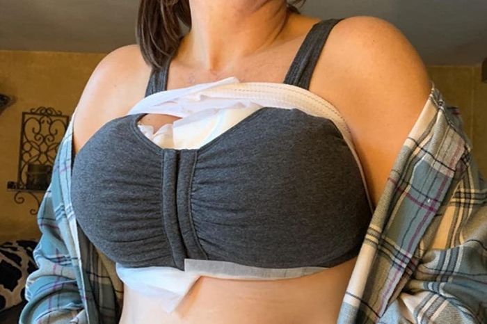 Reviewer wearing the sports bra post-op, front view