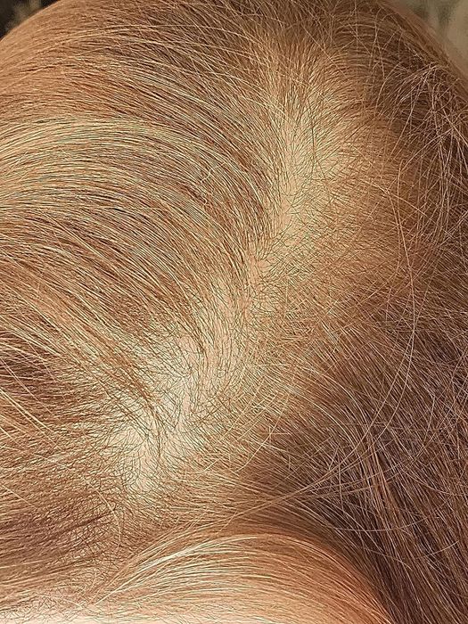 A photo of the same reviewer's roots looking clean and oil-free after using the product.