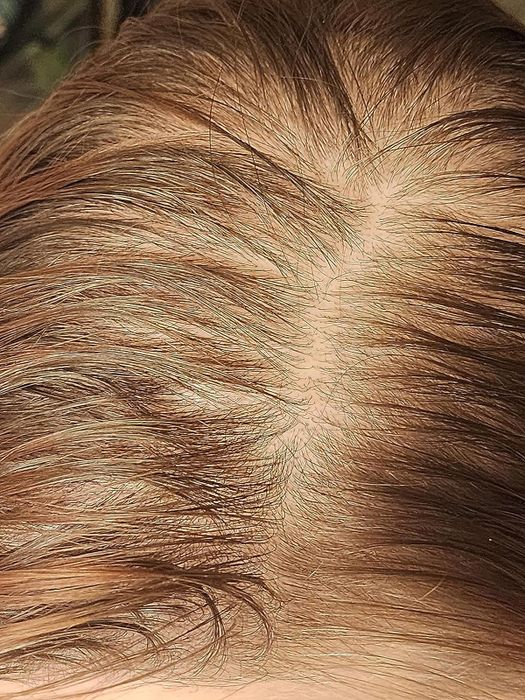 A close-up photo of a reviewer's oily roots before using the product.