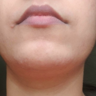 The same reviewer with smooth skin and no visible hair after using the product.