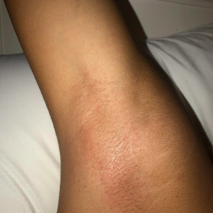 A different reviewer proudly showing off their smooth, post-wax armpit