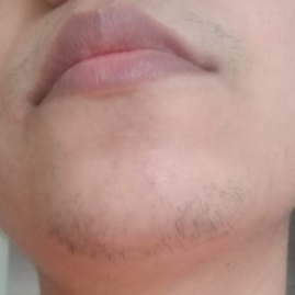 A reviewer showcasing dark, coarse hair on their upper lip and chin.